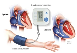 blood-pressure