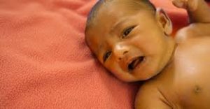 Neonatal Jaundice