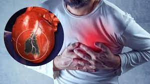 Heart Attack